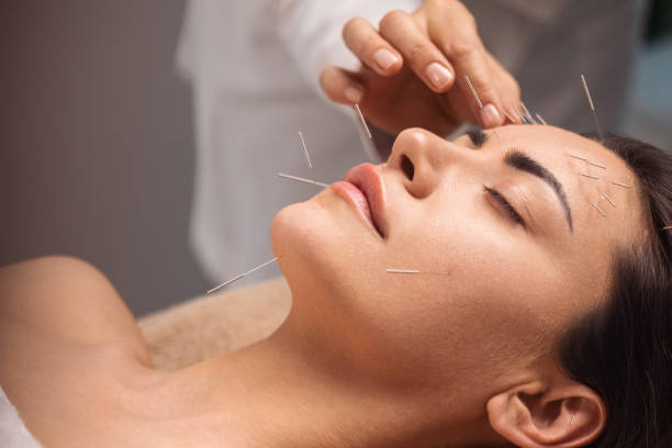 Physiotherapy North York - P&C Rehab Services for Rehabilitation | Introduction to Acupuncture: What You Need to Know