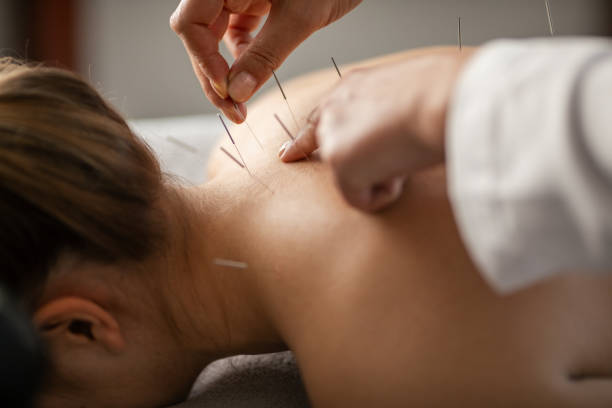 Acupuncture in Stress