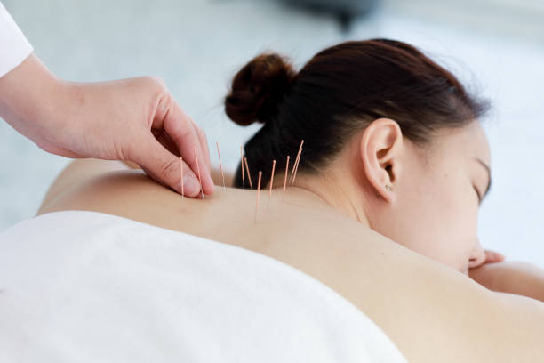 Physiotherapy and Acupuncture